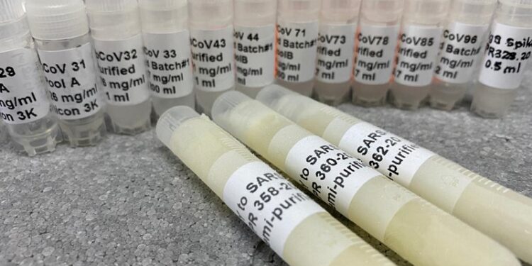 Dos recetas argentinas contra el coronavirus: Nebulizaciones con moléculas de llamas y gotitas de yema de huevo