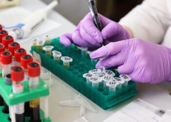 En Chile desarrollan un test que permitiría detectar en 20 minutos la tuberculosis en los bovinos