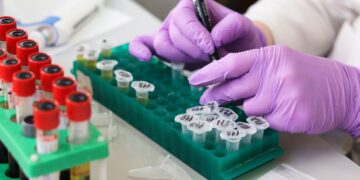 En Chile desarrollan un test que permitiría detectar en 20 minutos la tuberculosis en los bovinos